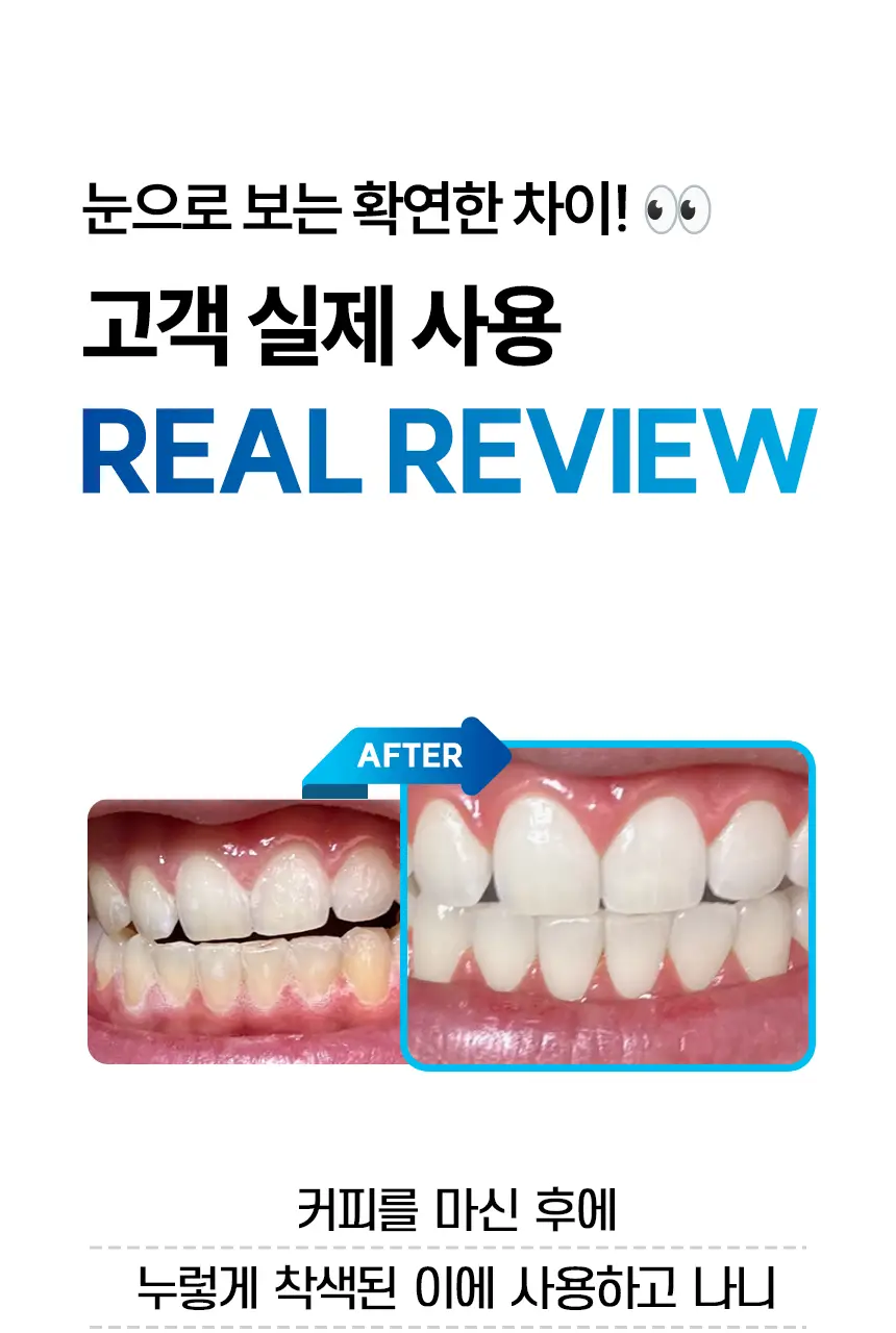 [NEW] 브리올 화이트닝 치아 미백제 4g (치과미백 동일성분) 상세페이지 18